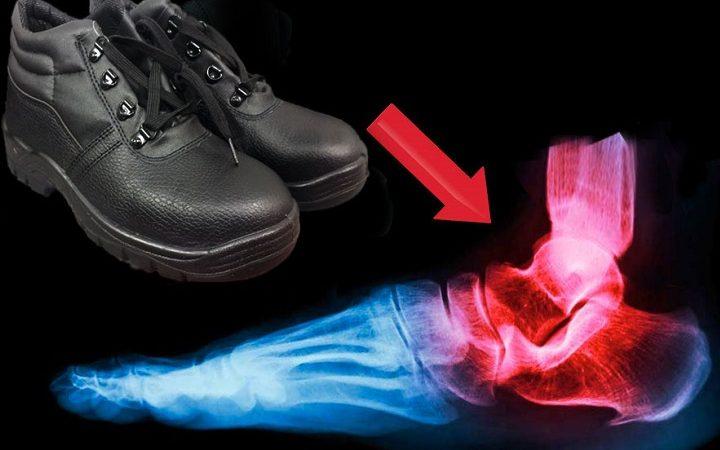 Are steel toe boots bad for your feet